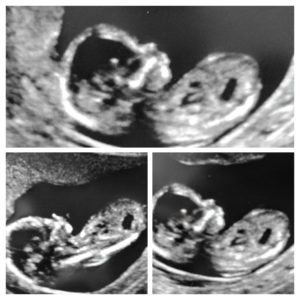 IMG_20160621_142738884-COLLAGE